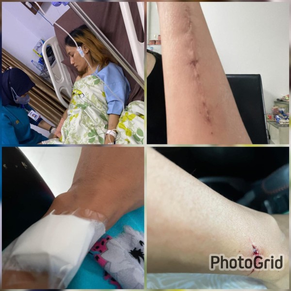 Diduga Alami KDRT , IRT Laporkan Suami Bulenya Ke Polresta Pekanbaru