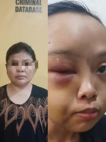 Menyedihkan !! Wajah Anak Yatim Piatu di Kampar Bonyok di Hajar Tante Kandung