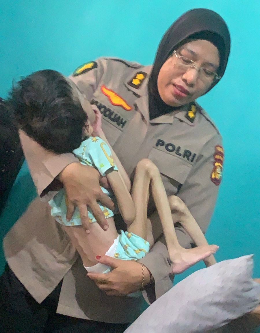 Kisah Siti Fadilla, Anak Penderita Hidrosefalus Dibuang Orang Tuanya Ini Tampak Ceria Digendong Polwan